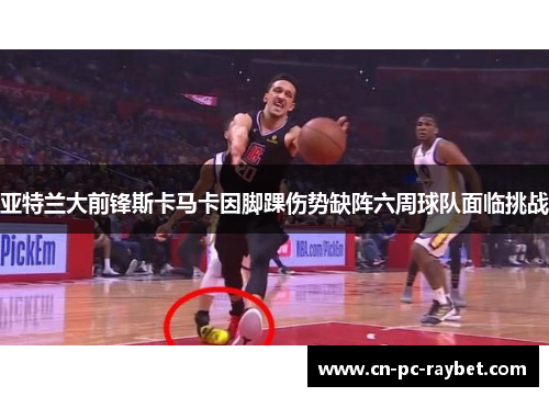 亚特兰大前锋斯卡马卡因脚踝伤势缺阵六周球队面临挑战